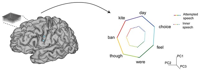 BrainDecoder