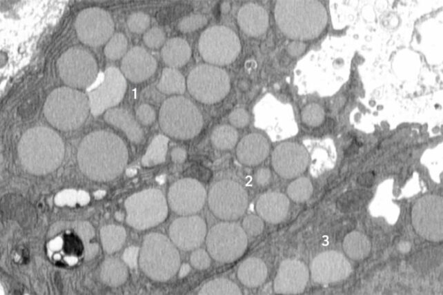 BrownCathartocytosis x x