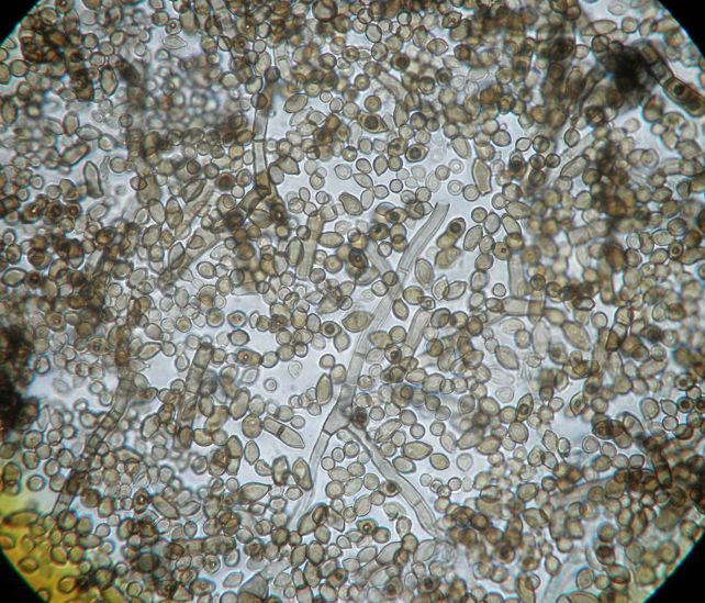 fungus microscope