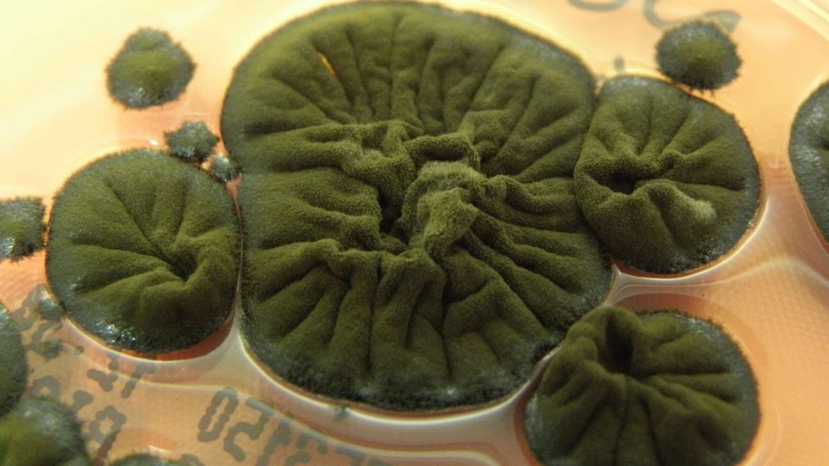 melanized fungus